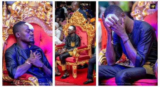Lilwin with plaster on his forehead after car accident